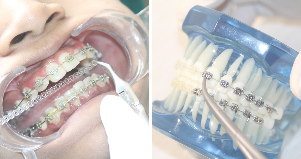 Orthodontics and the Path to Enhanced Mindfulness in Daily Routines