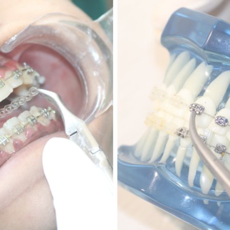 Orthodontics and the Path to Enhanced Mindfulness in Daily Routines