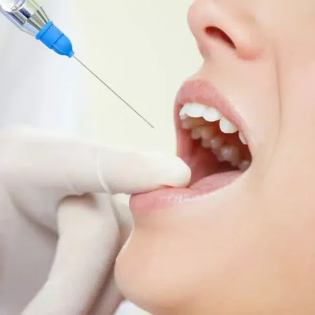 How Botox Injections Facilitate Improved Healing After Complex Dental Surgery