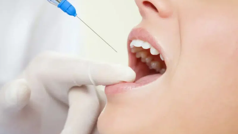 How Botox Injections Facilitate Improved Healing After Complex Dental Surgery